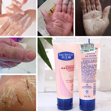 ointment cream nourishing hydrating cracking moisturizing vaseline elastic anti hand foot skin care good